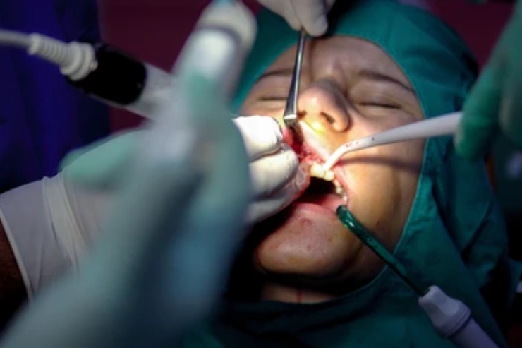Oral Surgery
