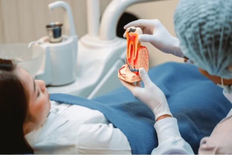 Root Canals-------20